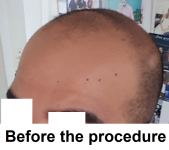 before2.png