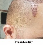 Procedure Day2.jpg