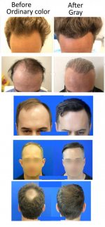 beforeaftergrey-resized.jpg