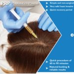PRP-Treatment01_19 (1).jpg