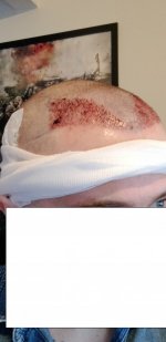 Day 1 Side 2 Edit.jpg Day 1 Side 2 Edit.jpg