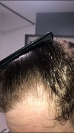 CF1F6E15-978E-45FF-B48C-D37E68870607.png