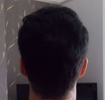 Crown Hair Combed back 6 month Dry 2.jpg