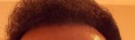 hairline 14 month.jpg