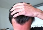 hairline 4.jpg