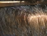 requested scar image.jpg