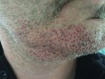 Day after 950 fue.jpg
