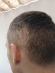 3 months shockloss.jpg