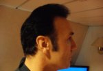 16 month post op right left side .JPG