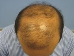 Before_Surgery.jpg