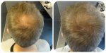crown nanogen treated light brown.jpg