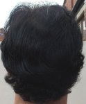 Crown 10 Months Post Op.jpg
