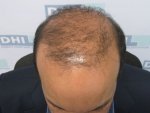 After 2 months.JPG
