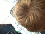 balding 2.jpeg