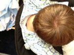 balding.jpeg