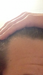 balding 3.png