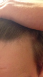 balding 4.png