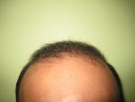 After 5 months - 2.JPG