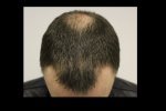 Hair 5 week 1.png.jpg