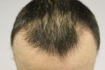 Hair 5 weeks 2.jpg