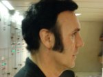 Right Side 24 Months Post Op .JPG