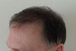 lside13mths.JPG