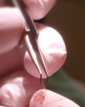 tiny grafts handled by forceps.jpg