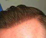 hair today.jpg