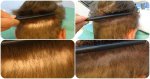 Strip scar enhancement2.jpg