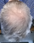 hair.png