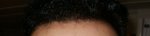 Hairline 22-06-14.JPG