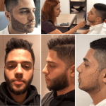 beard-transplant-istanbul-turkey.png
