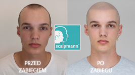 Scalpmann Mikropigmentacja.png