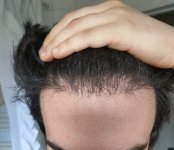 5 months center stronger light.jpg