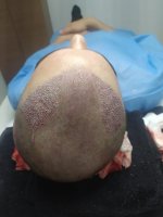 post op photo.jpeg