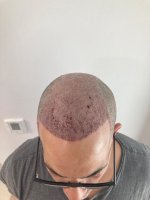 after surgery.jpeg