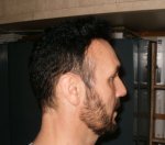 11 Weeks Post Op  Right Side .JPG