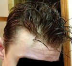 receded4.jpg