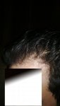 p 9 months after.jpg