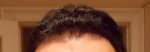 15-09-14 Hairline.JPG