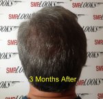 3monthstickening.jpg