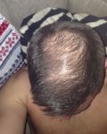 hair.jpg