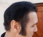 4 months 3 weeks Right Side.JPG