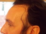 Left Side Pre Op.JPG