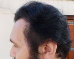 Left Side 4 months 3 weeks .JPG