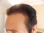 Left Side 4 montsh 3 weeks.JPG