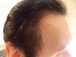 Right Side 4 months 3 weeks 2.JPG