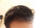 hairline right side.JPG