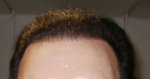 Hairline 13-10-14.jpg