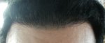 Hairline 28-10-14 2.jpg